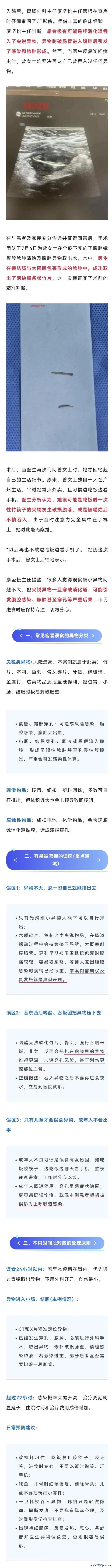 女子吃饭玩手机把竹筷碎片吞进肚子 腹痛原因竟是误吞筷子竹片